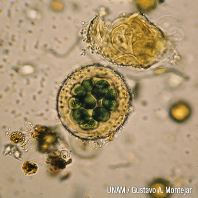 Bacterias-Asterocapsa-divina