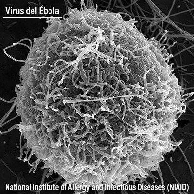 Virus del Ébola