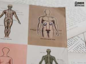 pacientes renales tratamiento México
