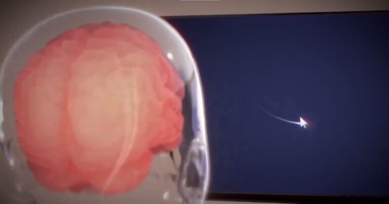 Neuralink Elon Musk cursor implante chip computadora