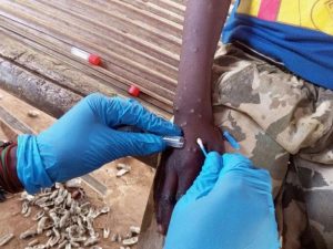 Mpox África vuelos frontera vacunas