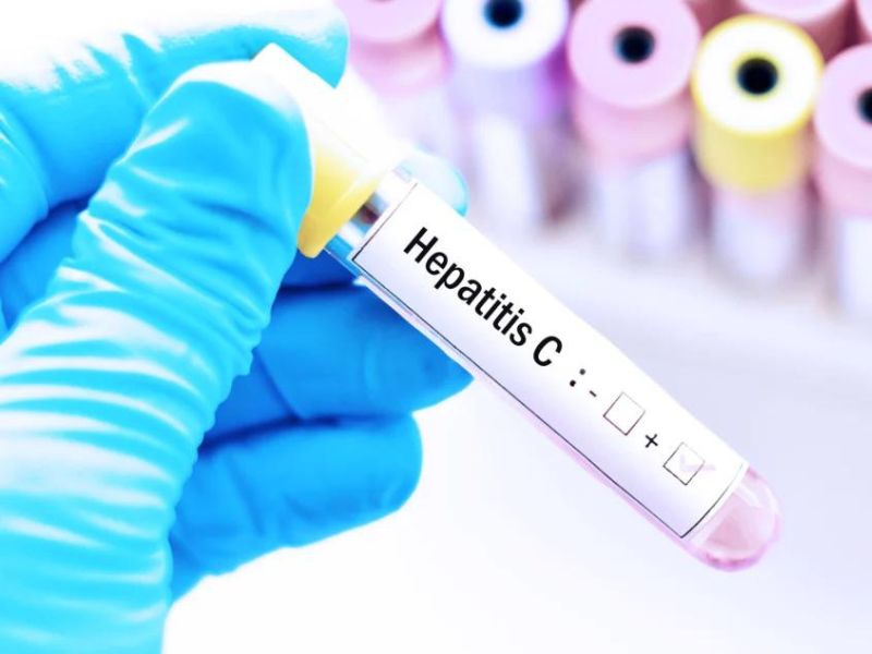 Cofepris medicamento Hepatitis C Cofepris medicamento Hepatitis C