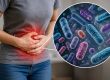 Descartan brote de cilosporiasis en México
